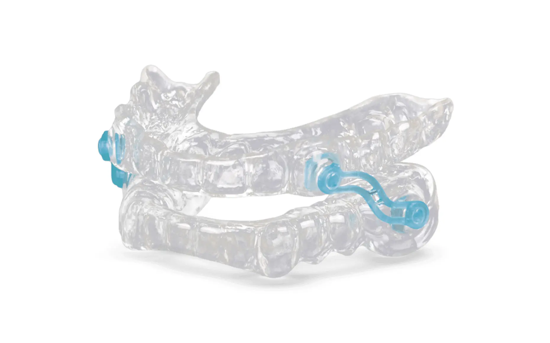 Daybreak custom oral appliance for sleep apnea