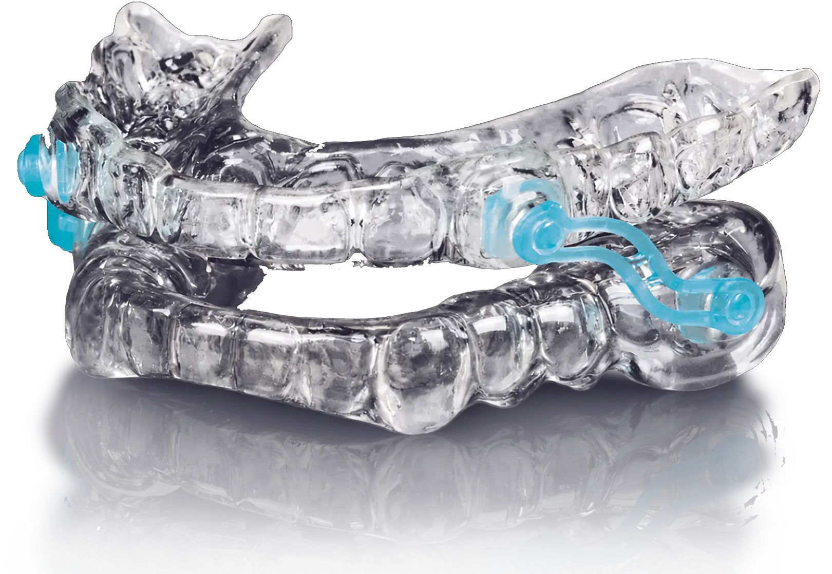 Daybreak custom oral appliance for sleep apnea